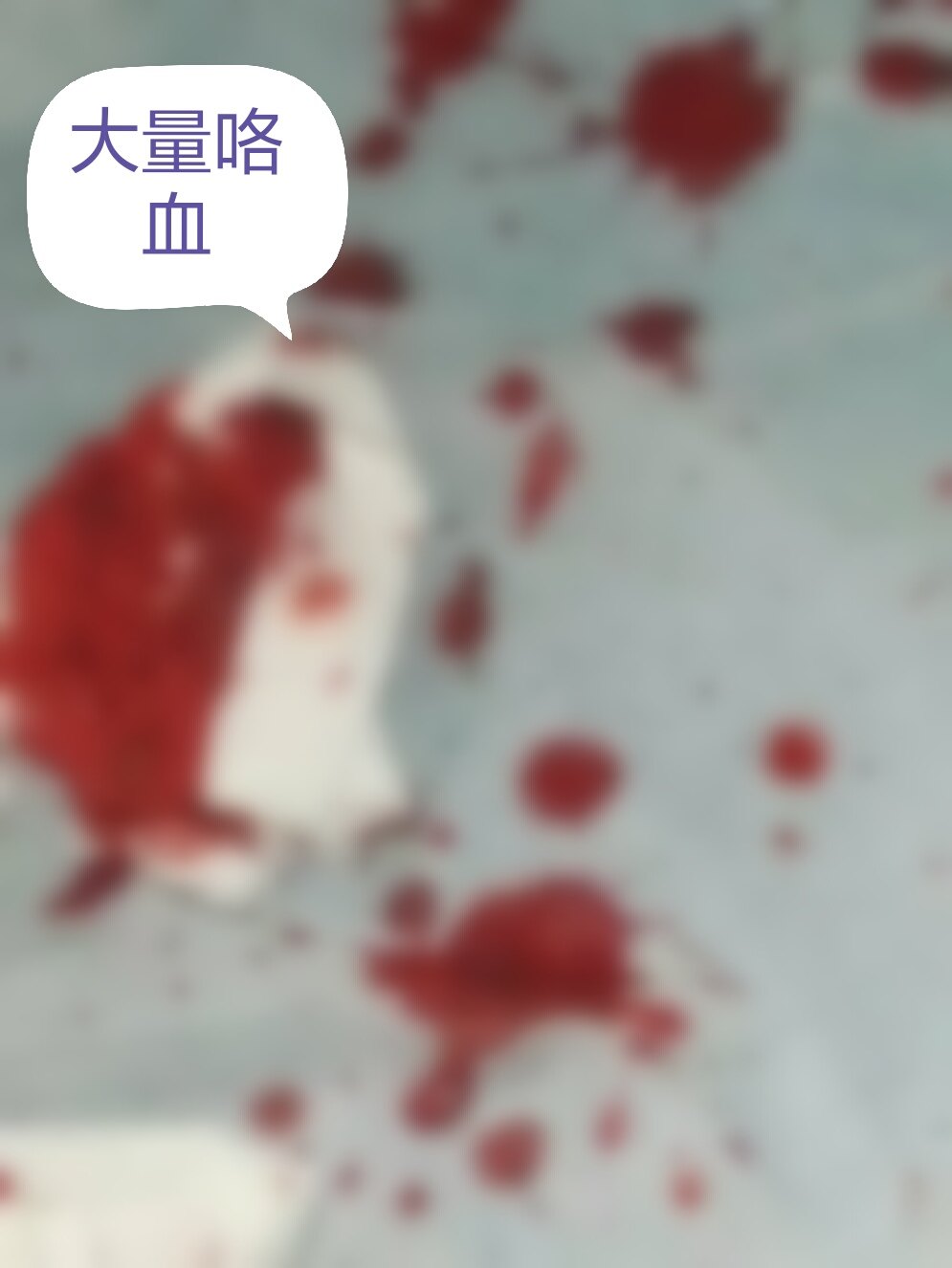 急性大咯血怎么办?