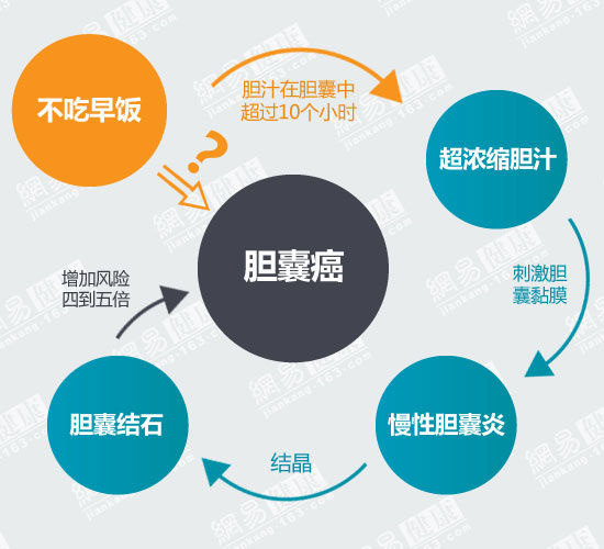 胆囊结石患者很多没有症状,因此不愿意手术,害怕手术.