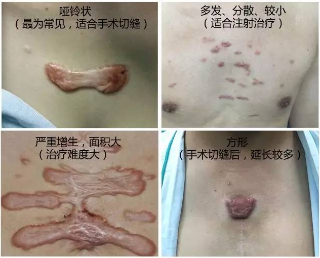 1505040754914724.png 图片.png