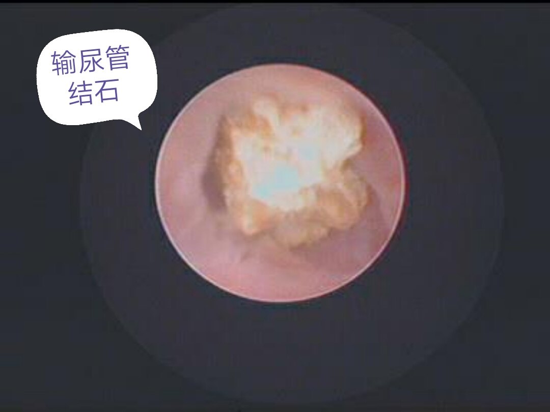 暂无