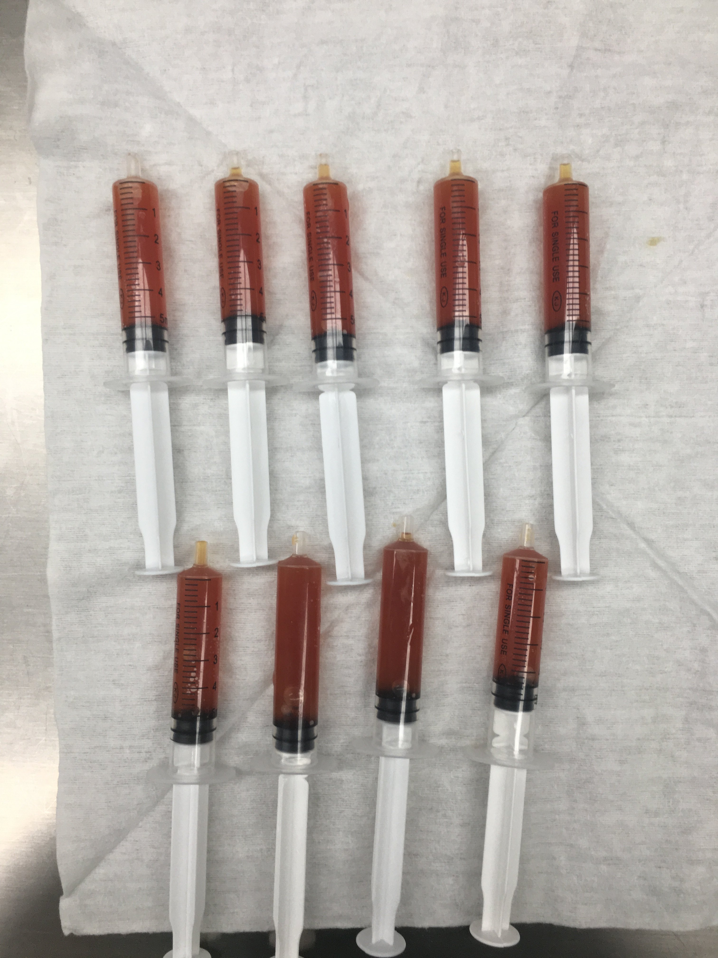 术中抽取血性淋巴液(出血量少)治疗后病灶完全消失本文系李炯医生授权