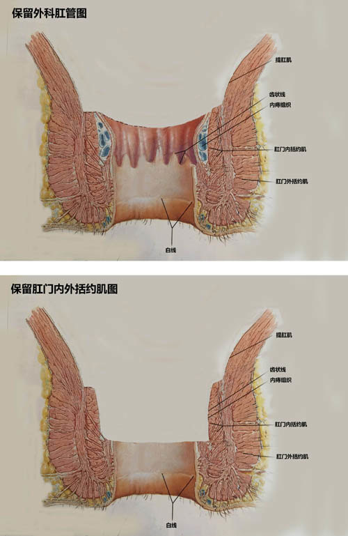 肛门齿状线图片