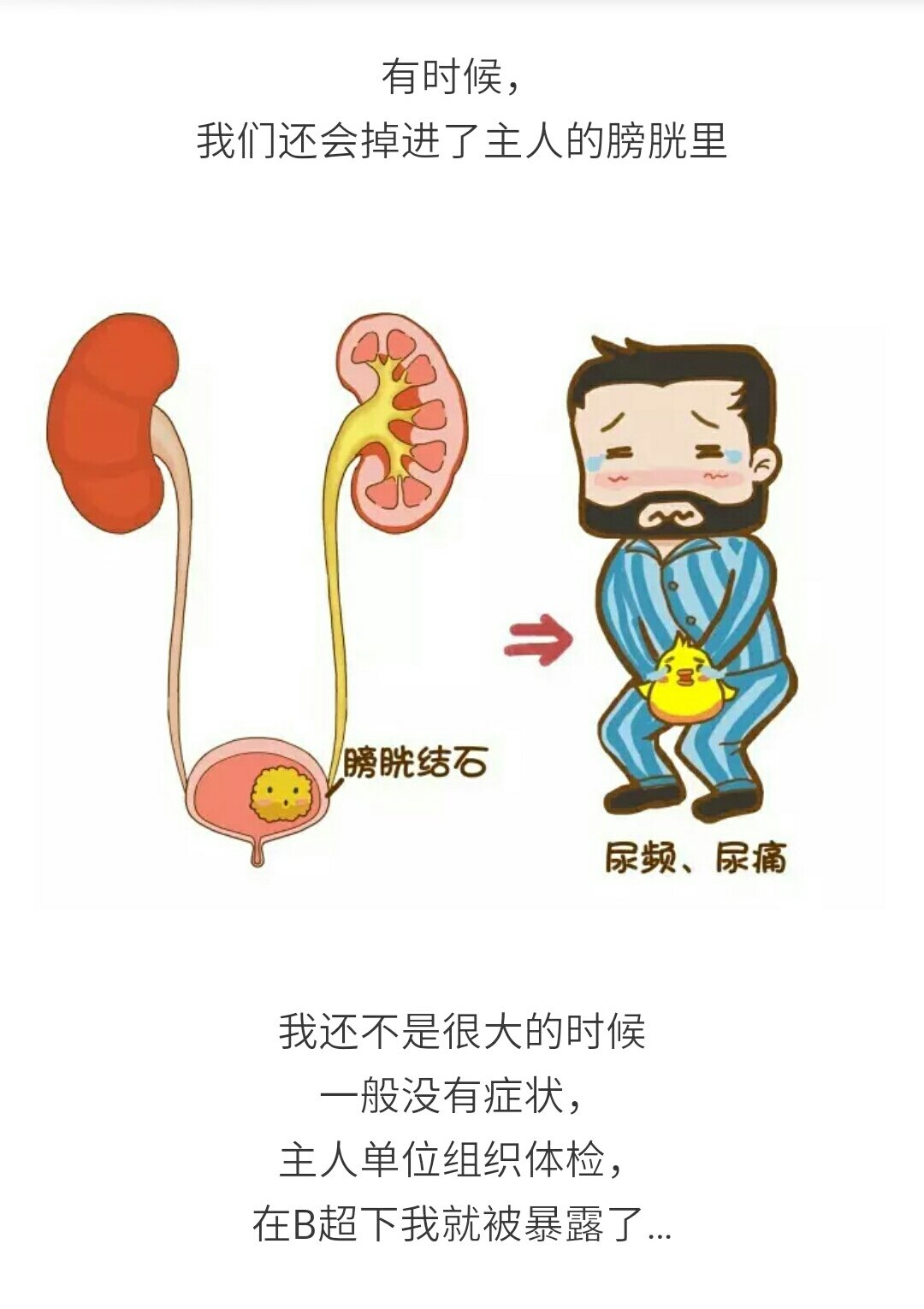 输尿管结石卡通图片图片