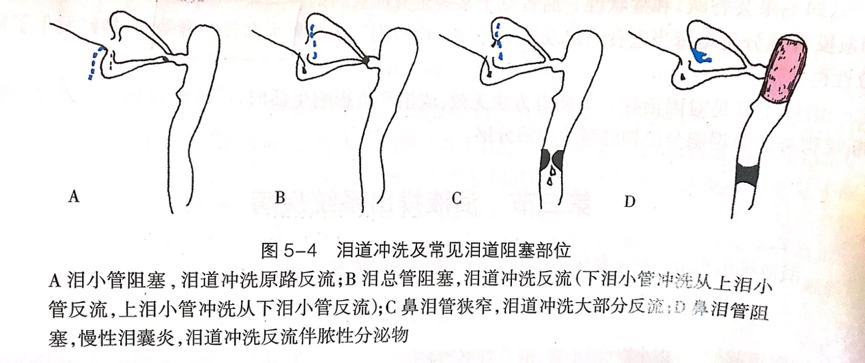 迎风流泪为哪般?