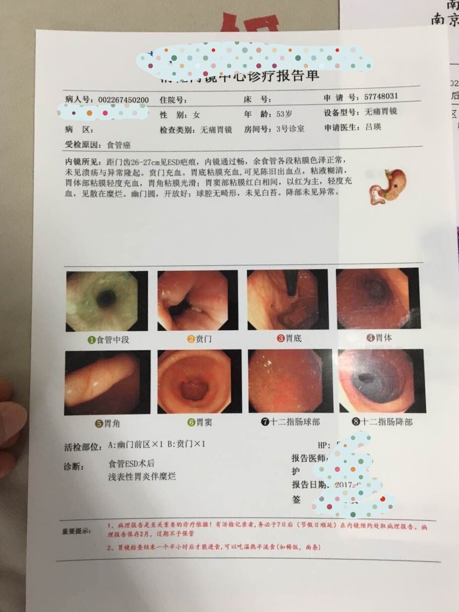 非常幸運,因為這個病人如果不做胃鏡,半年以後應該就是進展期食管癌了