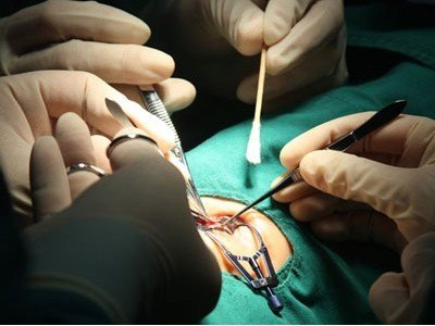 一个40年儿童斜视手术医生的斜视手术经验谈三
