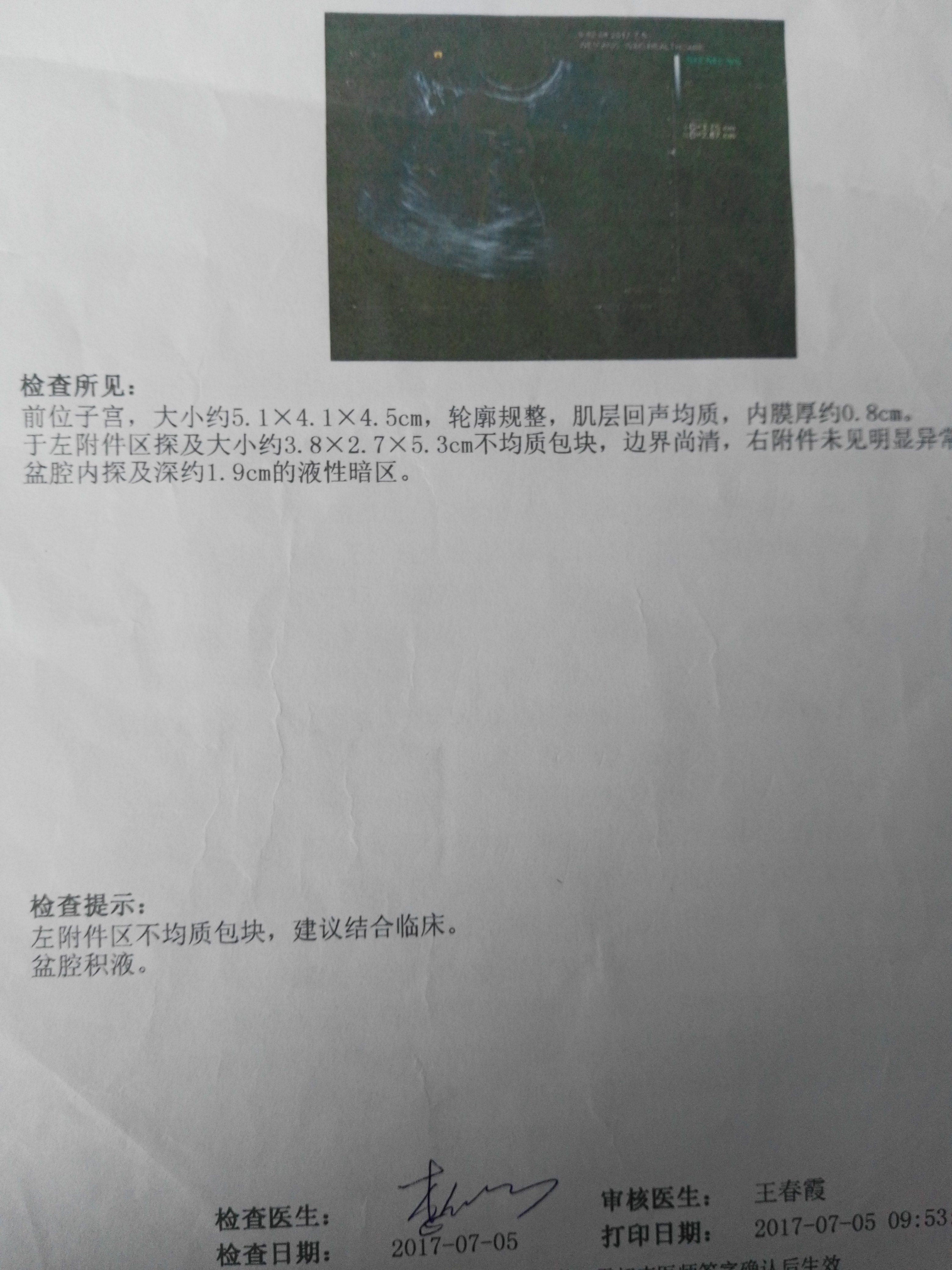教你学会自己看妇科彩超报告单
