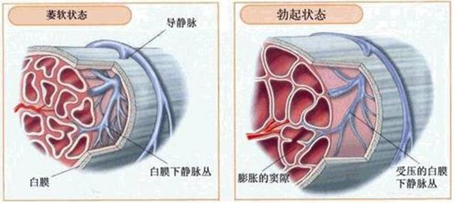 靜脈漏陽痿手術治療的新方法腹壁下動脈與陰莖背靜脈吻合