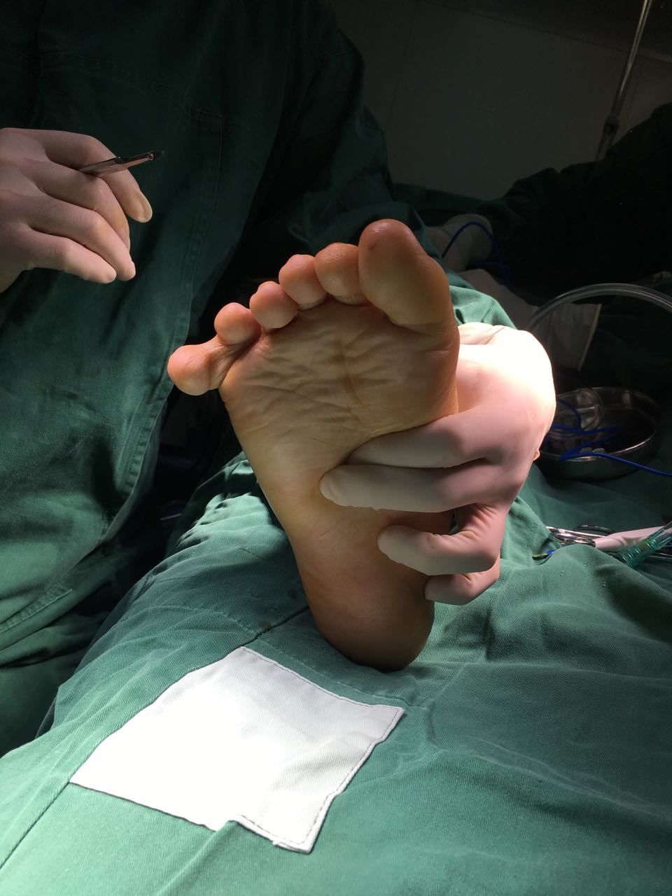 足部畸形矫正 - 好大夫在线