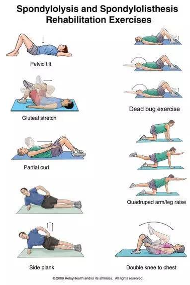 腰椎滑脱锻炼图动作图片