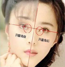 不开眼角能变理想效果吗?