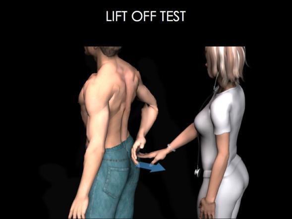 我肩关节疼痛肩袖损伤lift off抬离试验阳性是咋了?