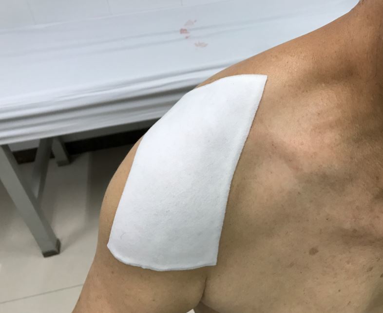 我肩肿痛是颈脊髓空洞症引起的夏科氏charcot关节病么