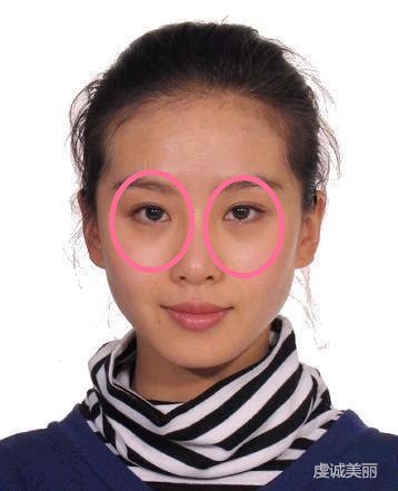 卧蚕最易出现在大眼睛或眼睛略凸的人身上,这种眼睛看上去格外的有