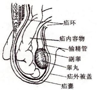 男宝宝疝环口位置图片图片