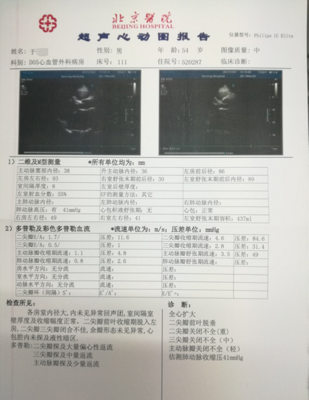 二尖瓣狭窄超声报告图片