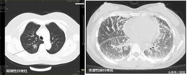 暂无