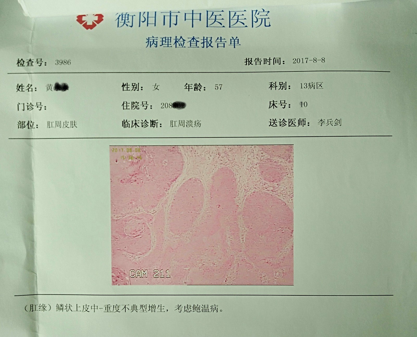 肛周鲍温氏病一例 - 好大夫在线