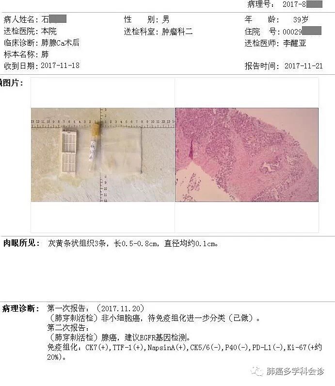 在给肺癌患者申请基因检测时要注意些什么?