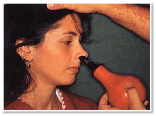 怎样让咽鼓管通畅?捏鼻鼓气还是吹张?