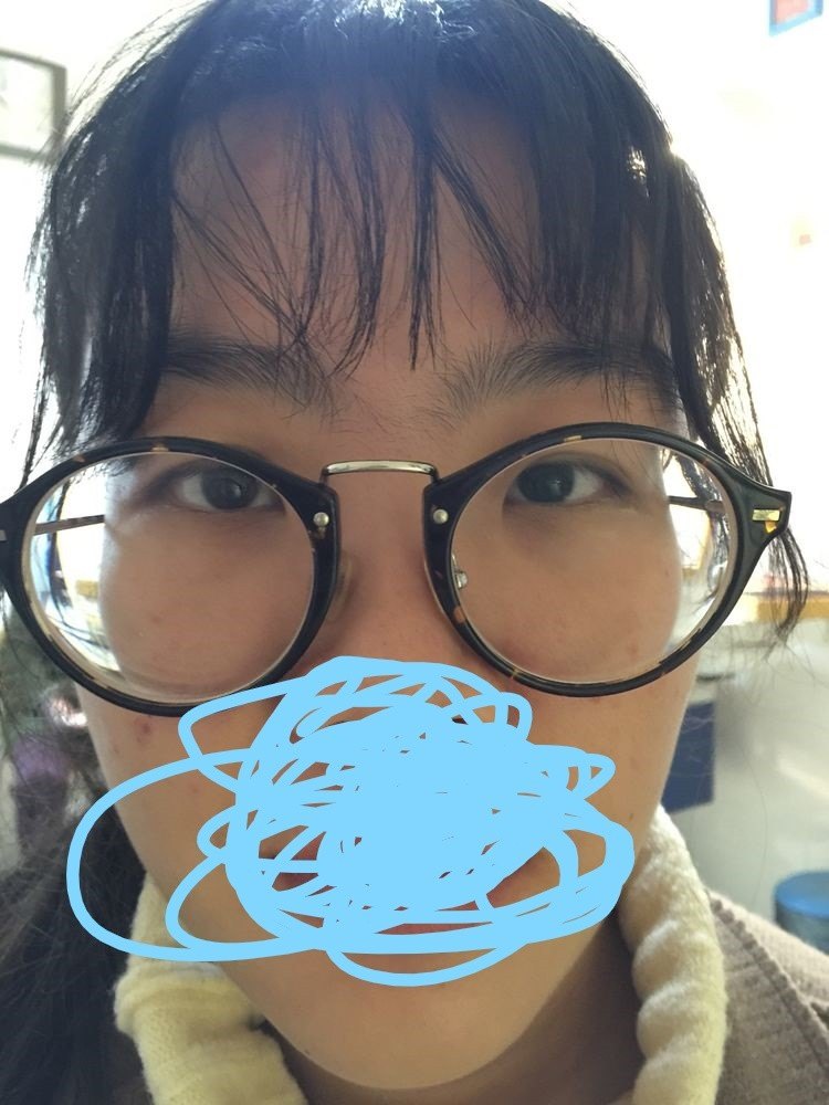 你换了大镜框却无意中害了自己的眼睛