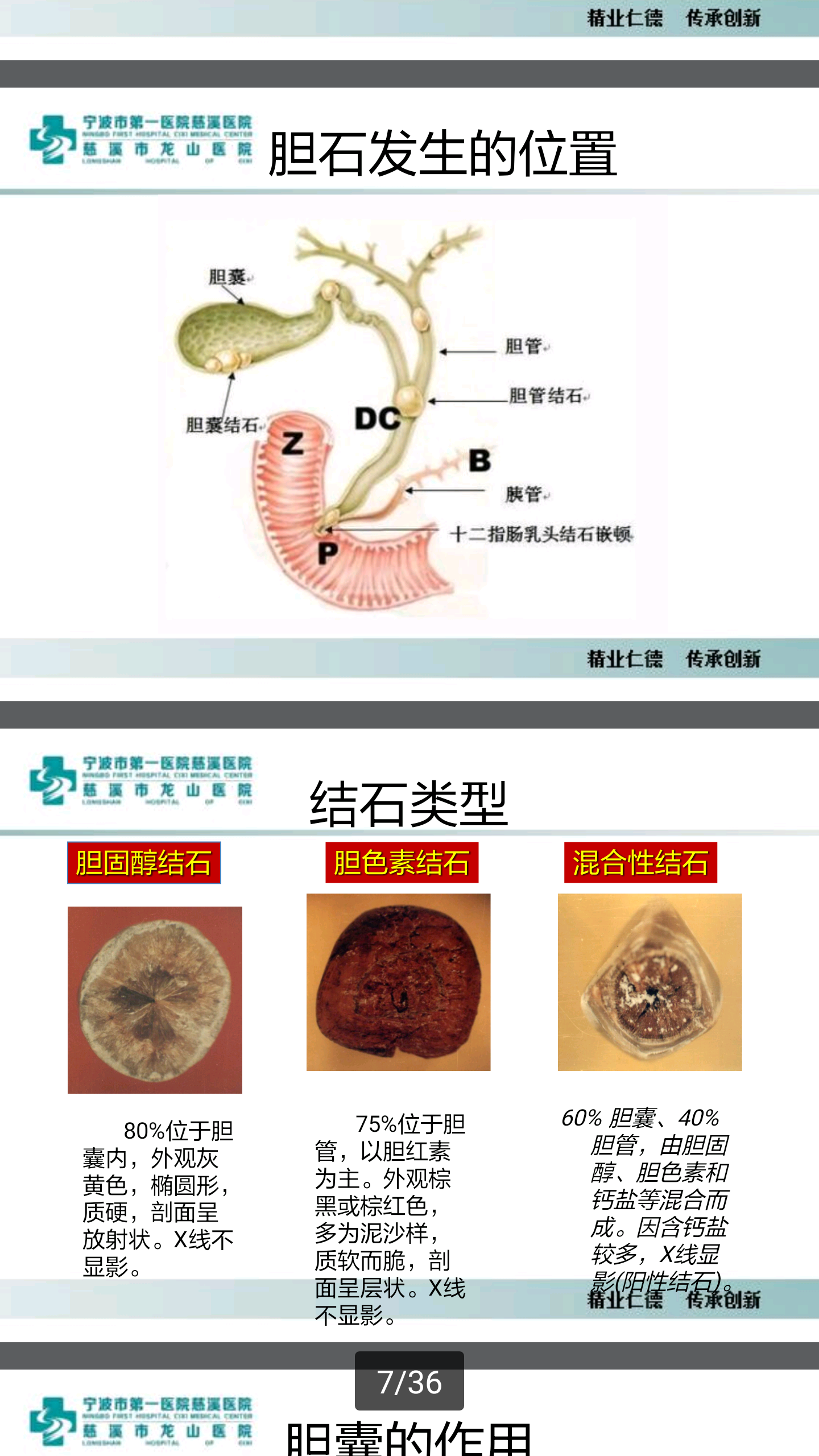 人体胆囊和胰腺解剖照片摄影图片_ID:166328644-Veer图库