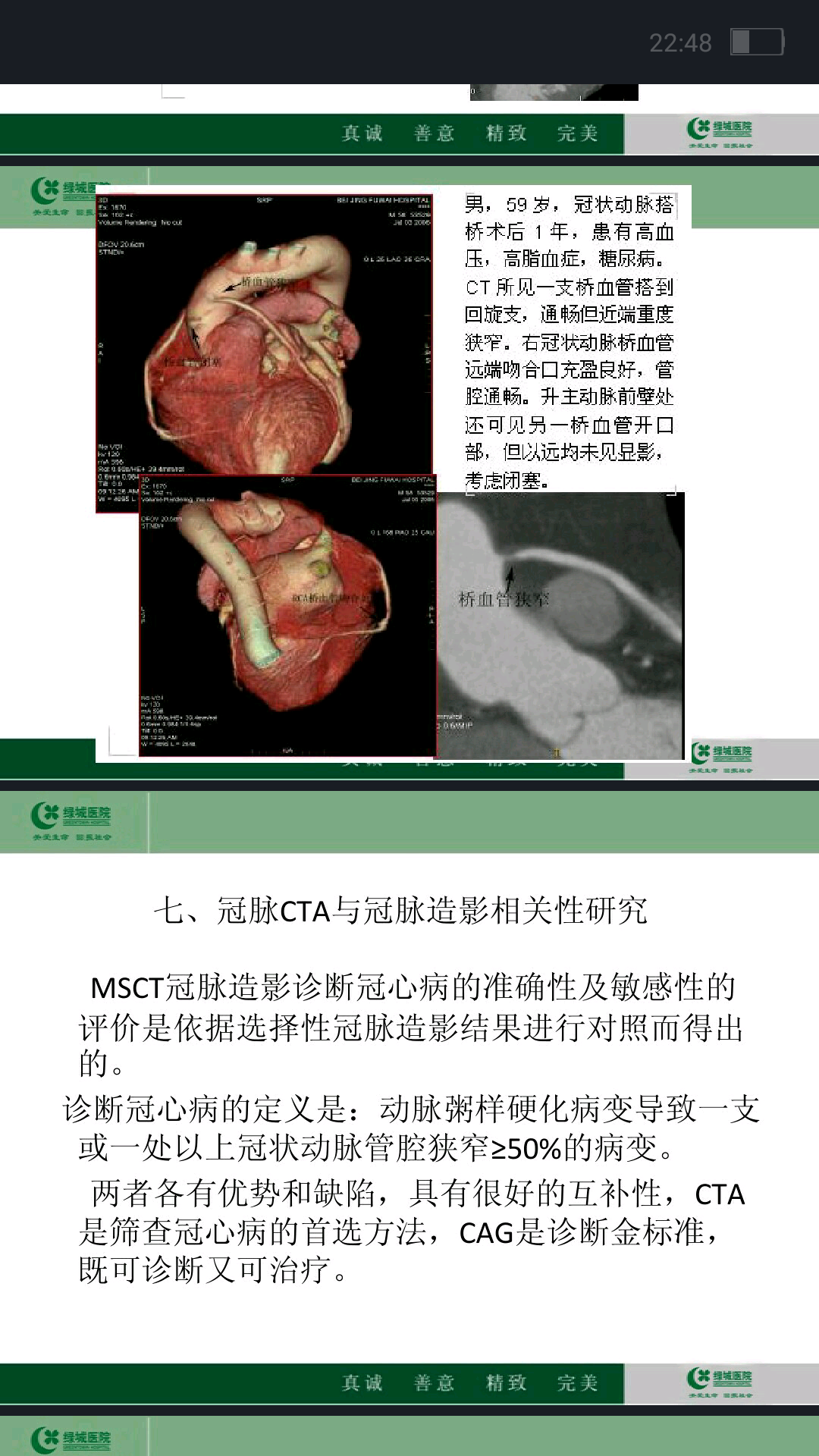 冠脉cta在冠心病检查的重要性 - 好大夫在线