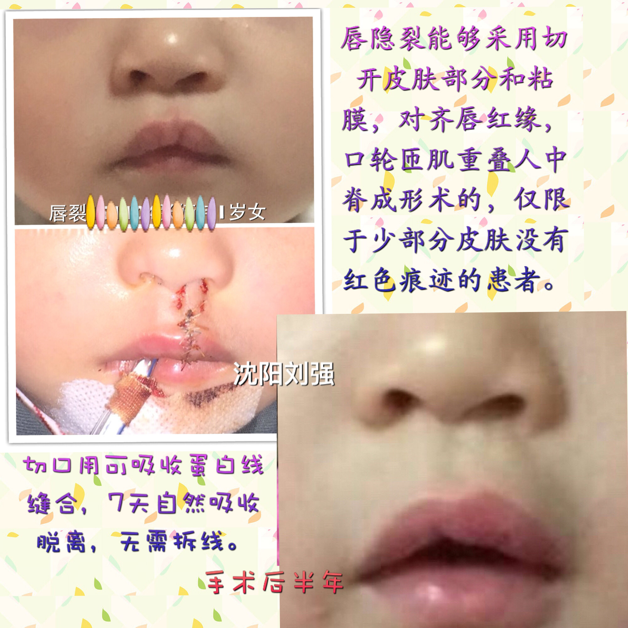 暂无