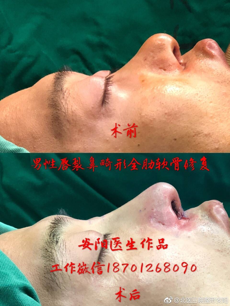 暂无