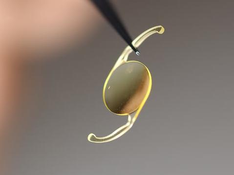 白内障患者如何选择手术时机