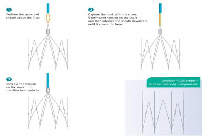 1531723376136872.png 可转换滤器示意图.png