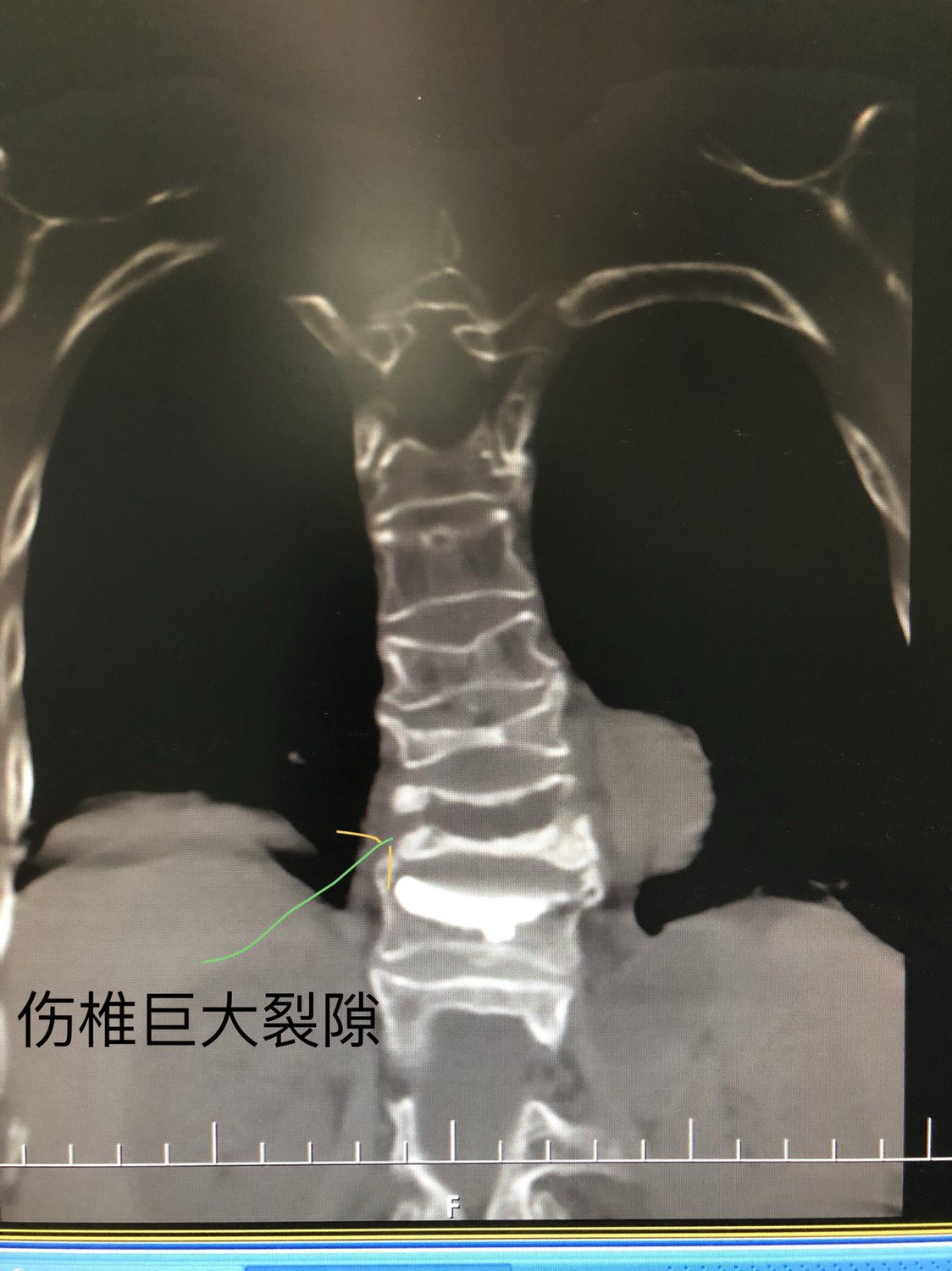 暂无