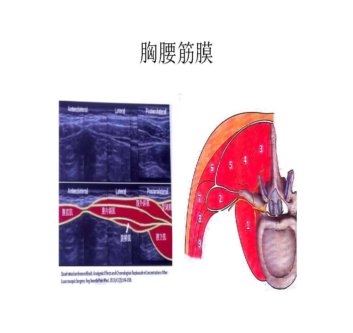 实用经竖脊肌平面阻滞治疗腰背部疼痛 - 好大夫在线