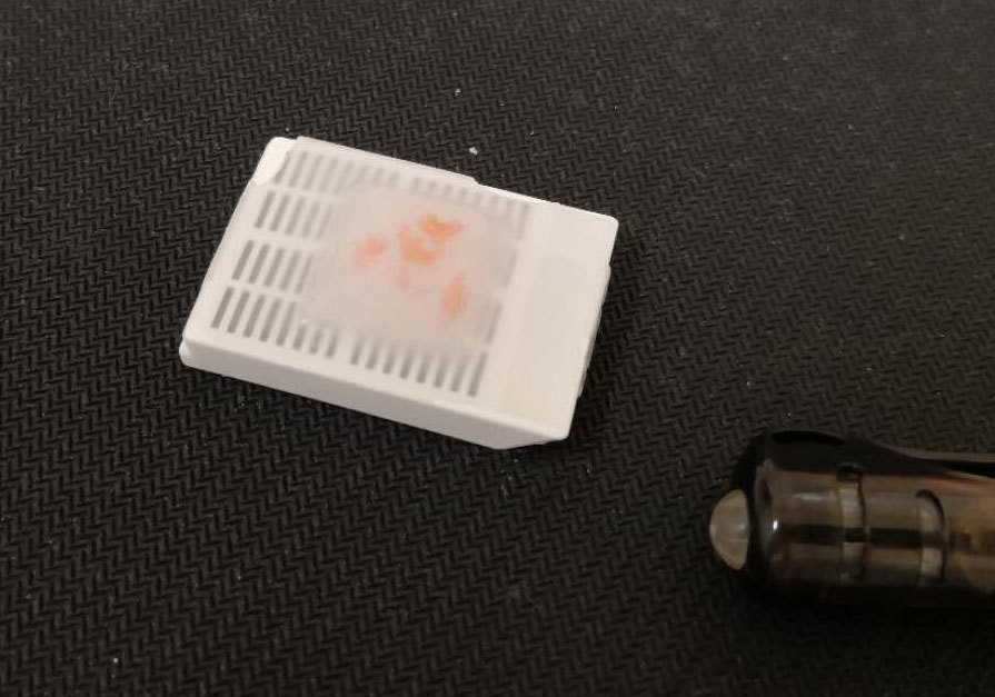 3) 病理切片或蜡块如何运输或保存?病理切片常温保存即可,不需要低温.