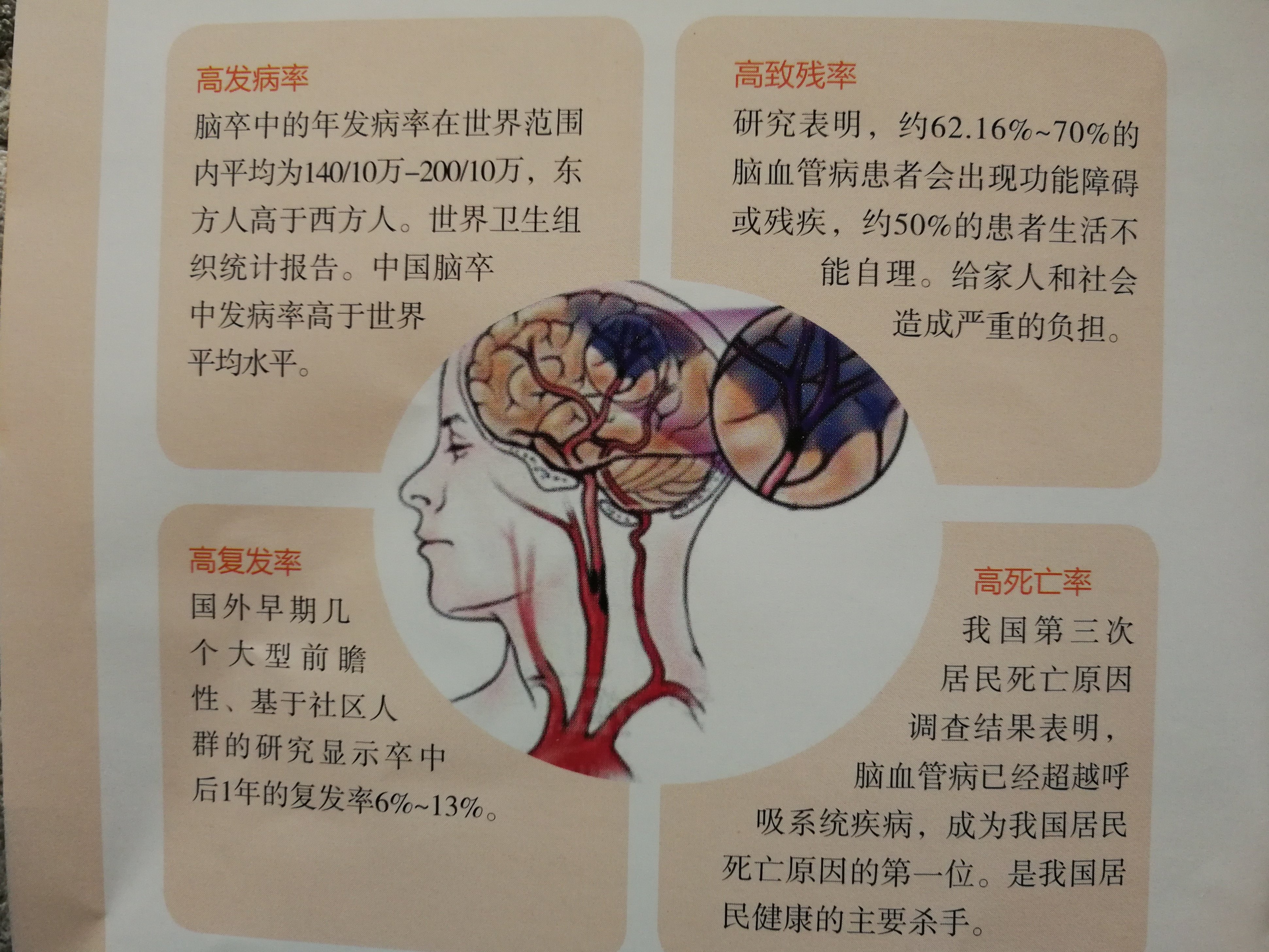 脑卒中后偏瘫患者的良肢位摆放 - 好大夫在线