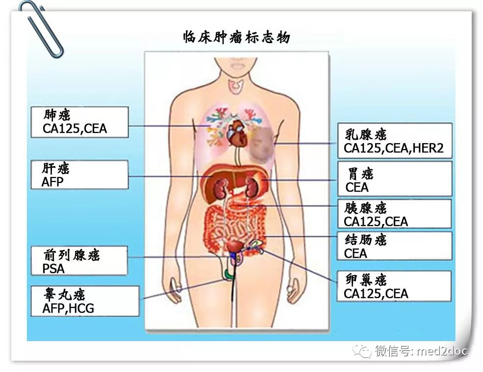 9,肿瘤标志物 高了也未必是肿瘤肿瘤标志物的特异性并非百分之百,并不