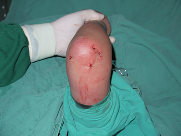 好大夫在线 李旭 李旭医生的患友会我为什么要做一名小儿骨科医生?