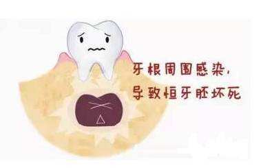 暂无