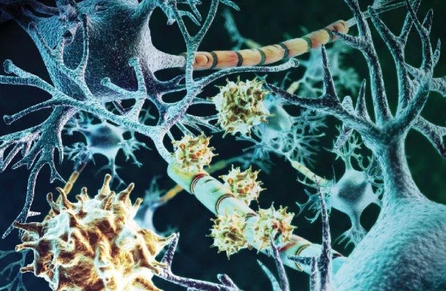 视神经脊髓炎的新疗法--干细胞治疗 - 好大夫在