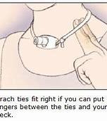 气管切开术后家庭护理_气管疾病_气管疾病手术 - 好大夫在线