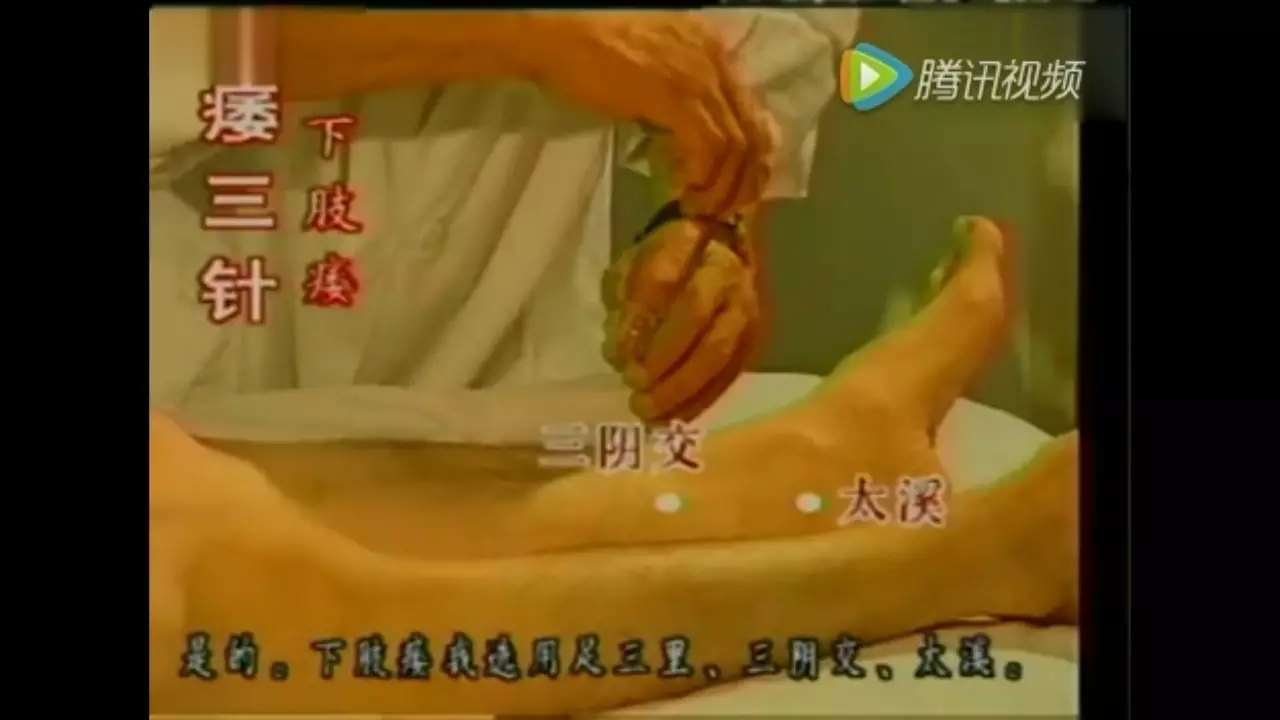 靳三针30组穴位(二) - 好大夫在线