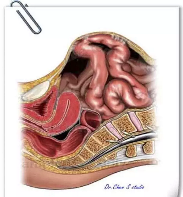 谈切口疝的治疗 - 好大夫在线