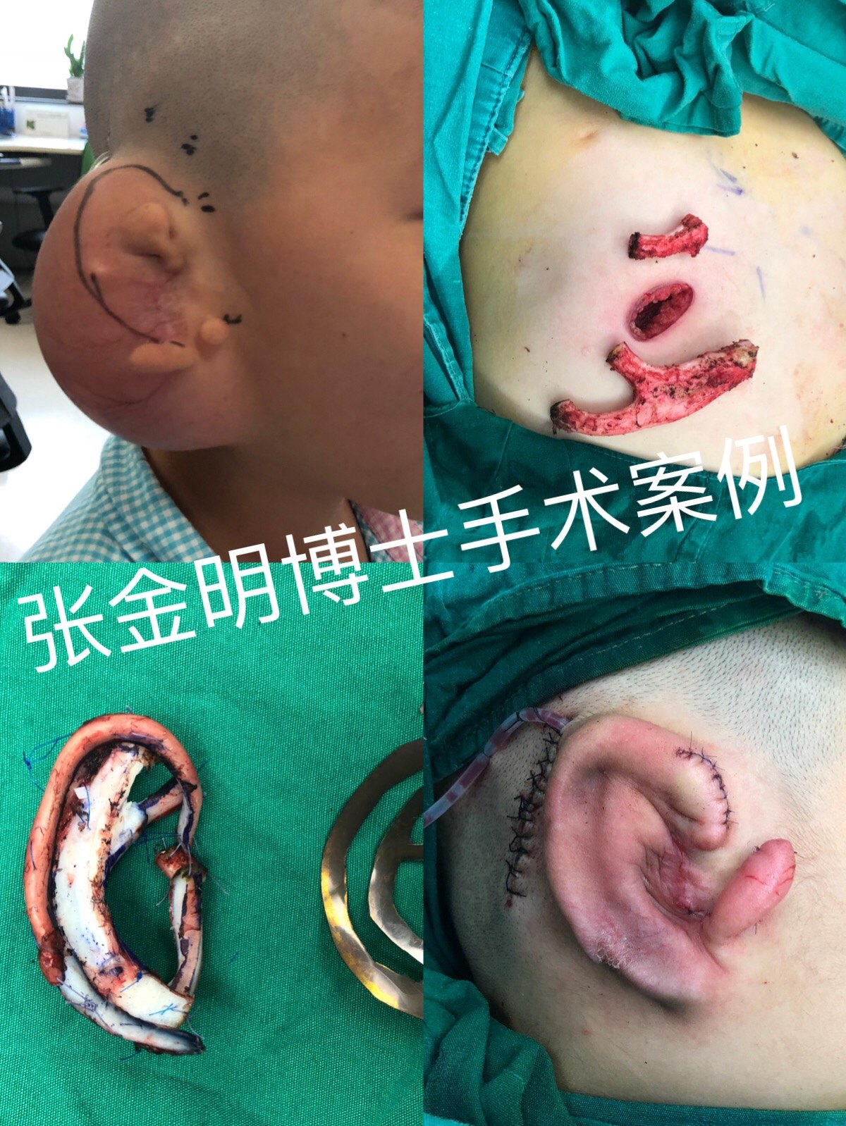 暂无