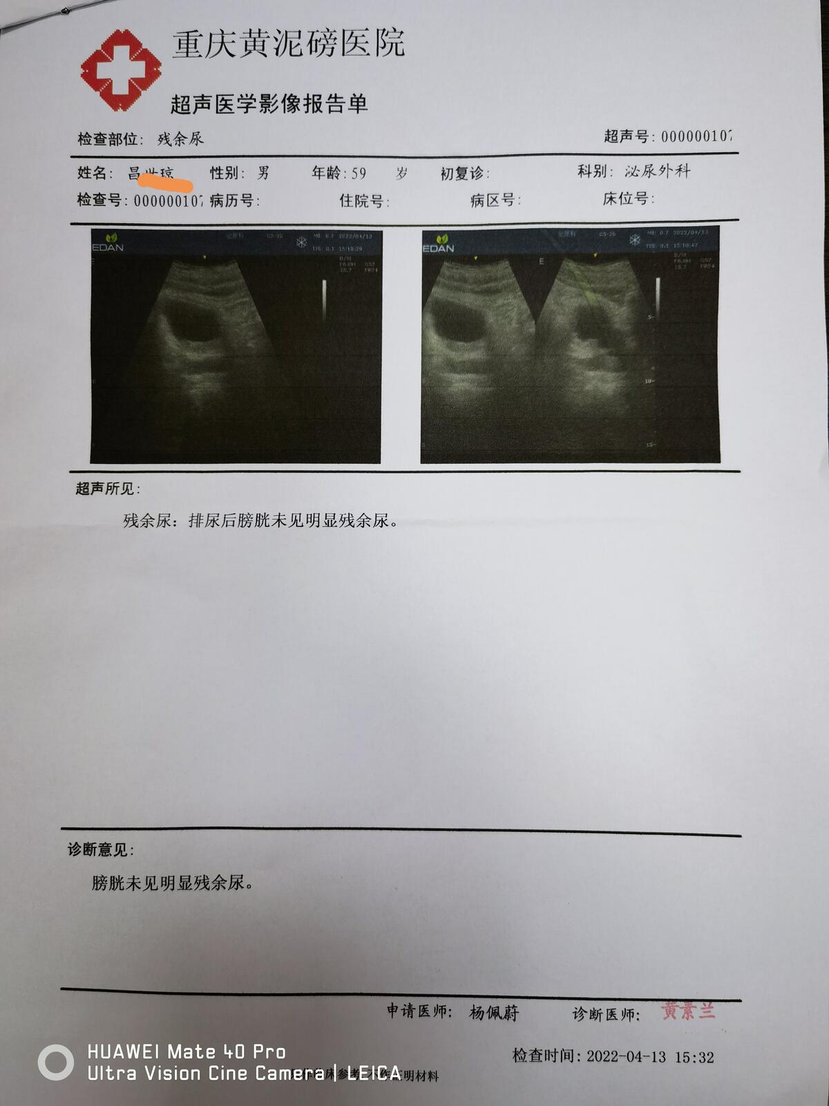 超声残余尿量测量图片图片