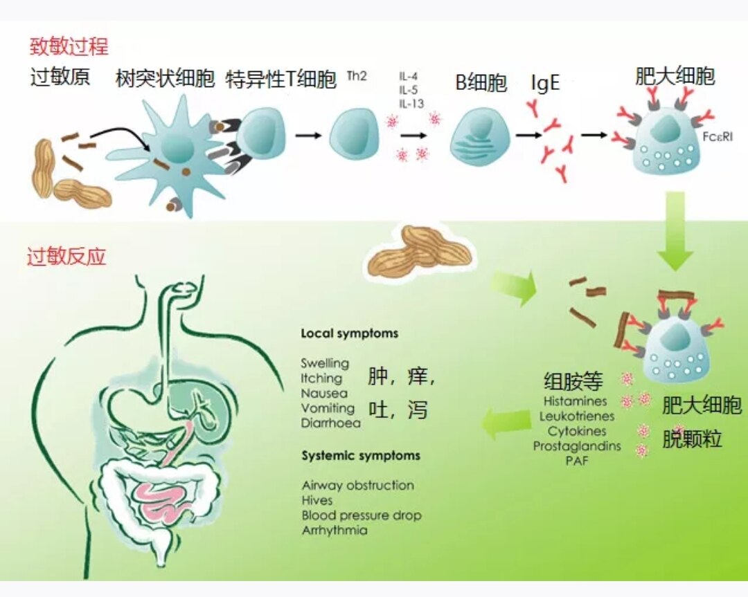 急性食物过敏机理 