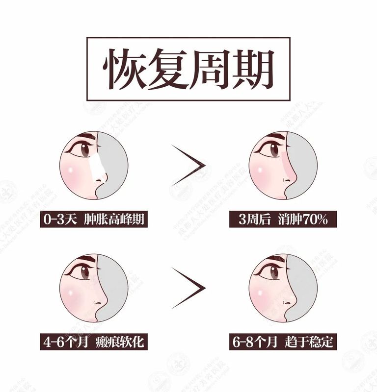 圖文圖片