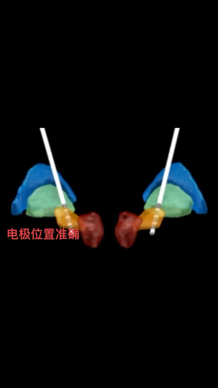 視頻封面