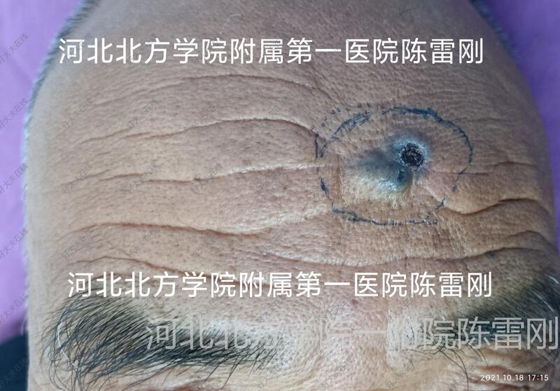 圖文圖片