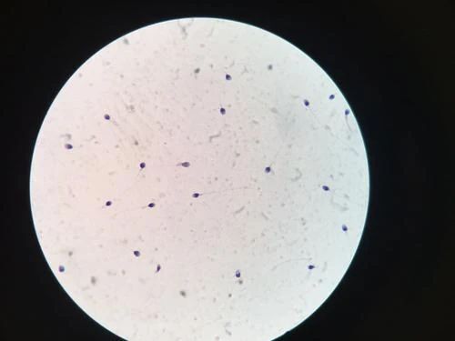 检查说无精,为什么睾丸活检,显微取精还能找到精子?