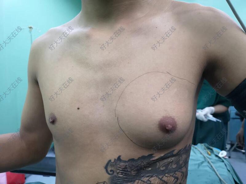 圖文圖片